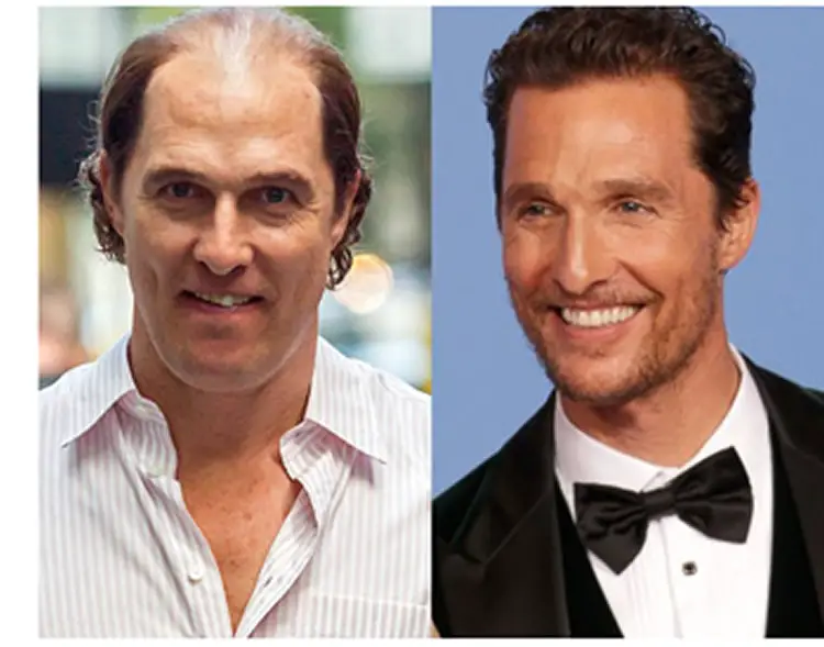 Matthew McConaughey Before and After