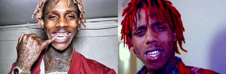 Famous Dex Teeth Photo