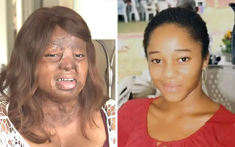 Kechi Okwuchi Before and After