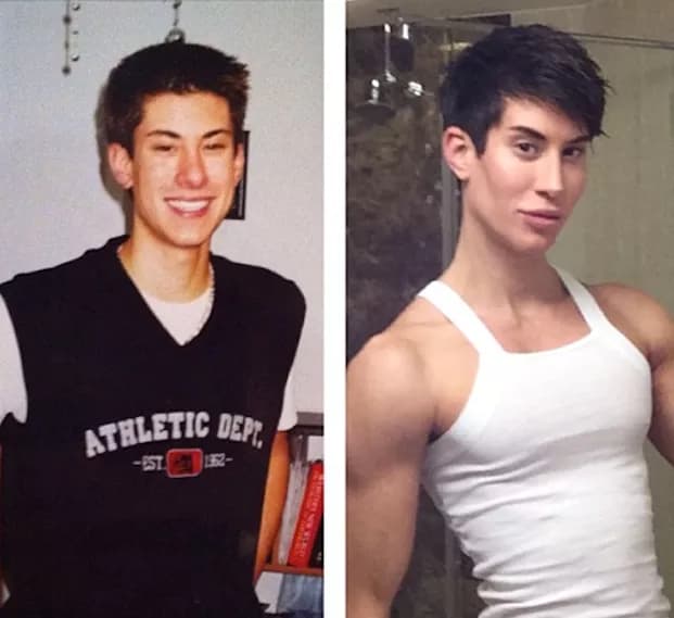 Justin Jedlica Before