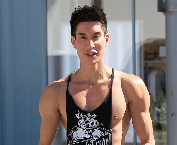 Justin Jedlica Bio Age Husband Before After Look Botched Surgeryjustin Jedlica Bio Wiki