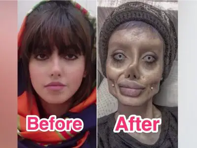 Sahar Tabar Befor And After