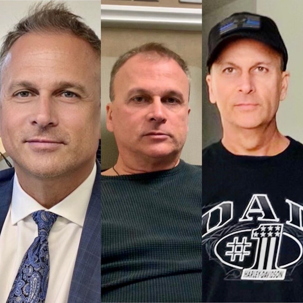 Simon Barney Photos of ‘Before, During, and After’ Cancer Treatment